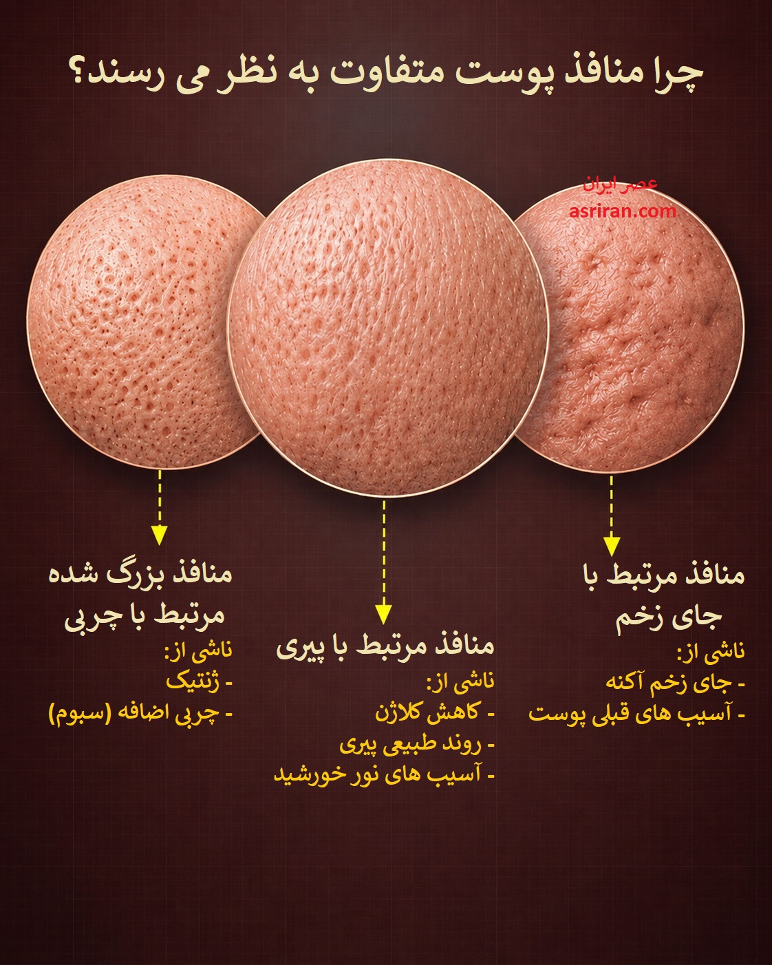 اینفوگرافیک مقایسه ظاهر منافذ پوست